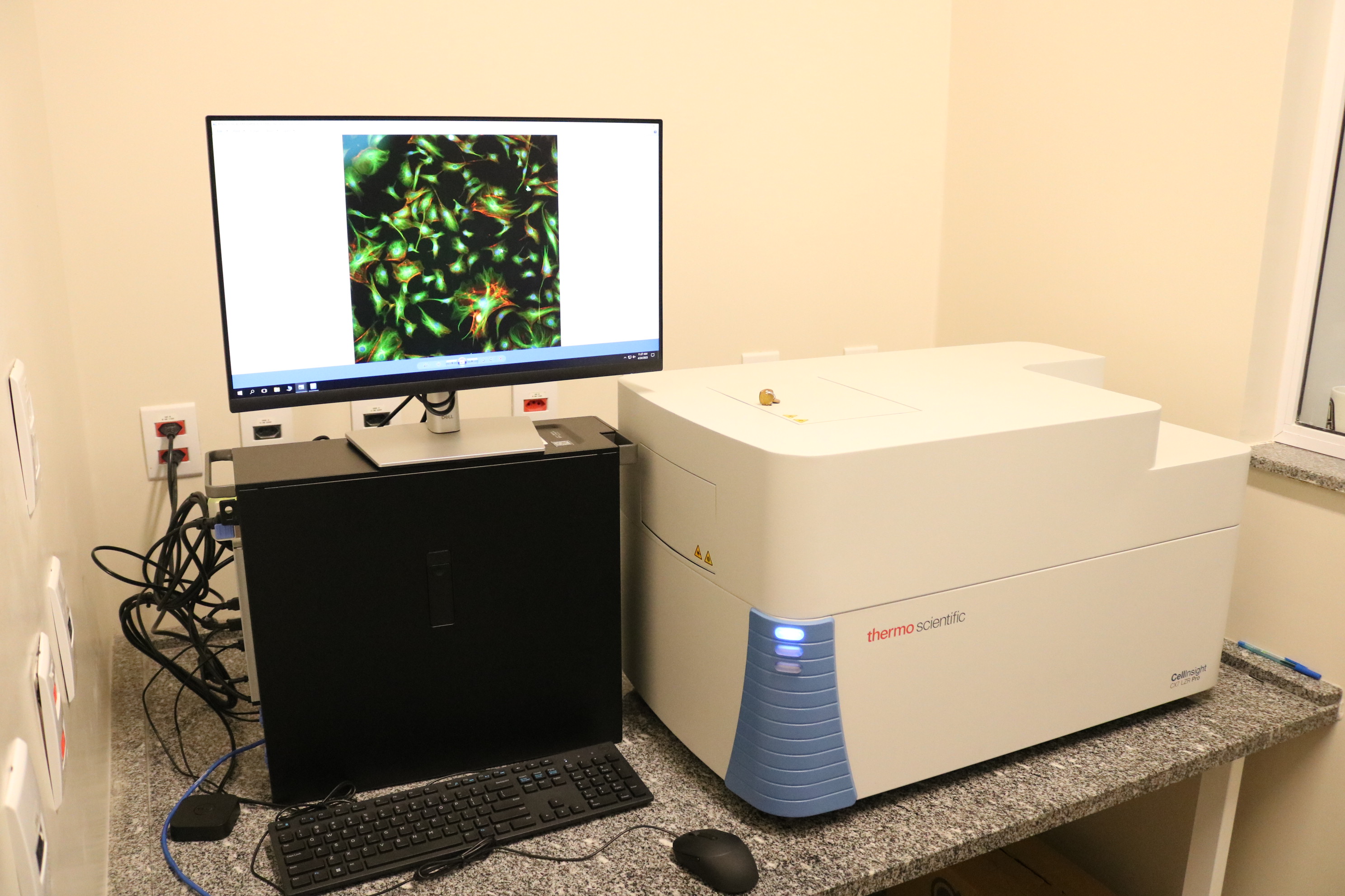 Toxin_HCA_High_Content_Analysis_CellInsight_CX7LZRpro.JPG